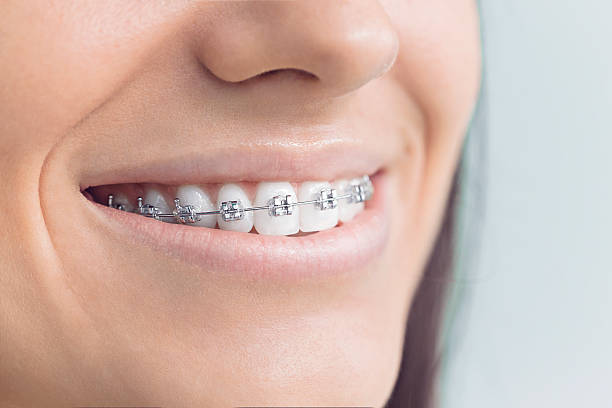 Why Choose Us for Your Dental Needs in Ross, CA